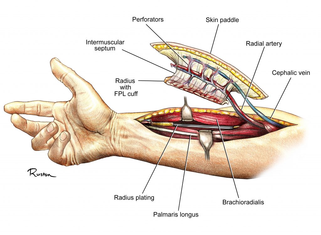 From Sketchbook to Scalpel The Medical Illustrations of Dr. Ruston